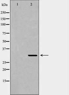 XRCC2 Antibody - Western blot analysis of HeLa whole cells lysates using XRCC2 antibody. The lane on the left is treated with the antigen-specific peptide.