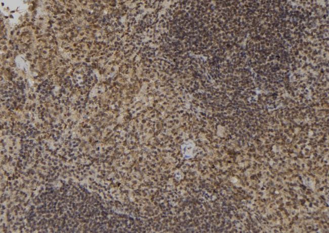 XRCC2 Antibody - 1:100 staining mouse spleen tissue by IHC-P. The sample was formaldehyde fixed and a heat mediated antigen retrieval step in citrate buffer was performed. The sample was then blocked and incubated with the antibody for 1.5 hours at 22°C. An HRP conjugated goat anti-rabbit antibody was used as the secondary.