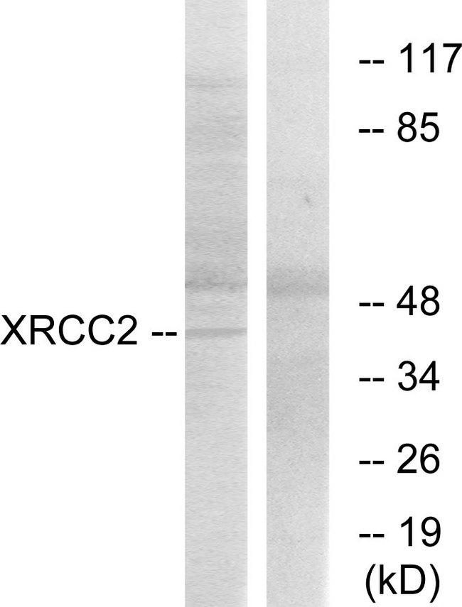 XRCC2 Antibody - Western blot analysis of extracts from 293cells, using XRCC2 antibody.
