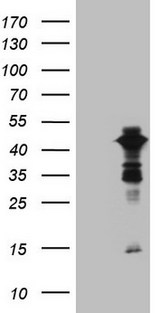 XRCC3 Antibody - HEK293T cells were transfected with the pCMV6-ENTRY control. (Left lane) or pCMV6-ENTRY XRCC3. (Right lane) cDNA for 48 hrs and lysed. Equivalent amounts of cell lysates. (5 ug per lane) were separated by SDS-PAGE and immunoblotted with anti-XRCC3. (1:2000)