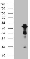 XRCC3 Antibody - HEK293T cells were transfected with the pCMV6-ENTRY control. (Left lane) or pCMV6-ENTRY XRCC3. (Right lane) cDNA for 48 hrs and lysed. Equivalent amounts of cell lysates. (5 ug per lane) were separated by SDS-PAGE and immunoblotted with anti-XRCC3. (1:2000)
