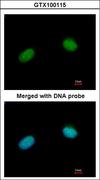 XRCC3 Antibody - Immunofluorescence of paraformaldehyde-fixed HeLa using XRCC3 antibody at 1:200 dilution.