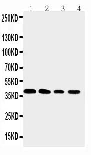 XRCC3 Antibody - WB of XRCC3 antibody. All lanes: Anti-XRCC3 at 0.5ug/ml. Lane 1: JURKAT Whole Cell Lysate at 40ug. Lane 2: HT1080 Whole Cell Lysate at 40ug. Lane 3: COLO320 Whole Cell Lysate at 40ug. Lane 4: MM231 Whole Cell Lysate at 40ug. Predicted bind size: 38KD. Observed bind size: 38KD.