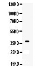 XRCC3 Antibody - Western blot analysis of -XRCC3 using anti--XRCC3 antibody. Electrophoresis was performed on a 5-20% SDS-PAGE gel at 70V (Stacking gel) / 90V (Resolving gel) for 2-3 hours. The sample well of each lane was loaded with 50ug of sample under reducing conditions. Lane 1: Mouse Brain Tissue Lysates, After Electrophoresis, proteins were transferred to a Nitrocellulose membrane at 150mA for 50-90 minutes. Blocked the membrane with 5% Non-fat Milk/ TBS for 1.5 hour at RT. The membrane was incubated with rabbit anti--XRCC3 antigen affinity purified polyclonal antibody at 0.5 µg/mL overnight at 4°C, then washed with TBS-0.1% Tween 3 times with 5 minutes each and probed with a goat anti-rabbit IgG-HRP secondary antibody at a dilution of 1:10000 for 1.5 hour at RT. The signal is developed using an Enhanced Chemiluminescent detection (ECL) kit with Tanon 5200 system. A specific band was detected for -XRCC3 at approximately 38KD. The expected band size for -XRCC3 is at 38KD.