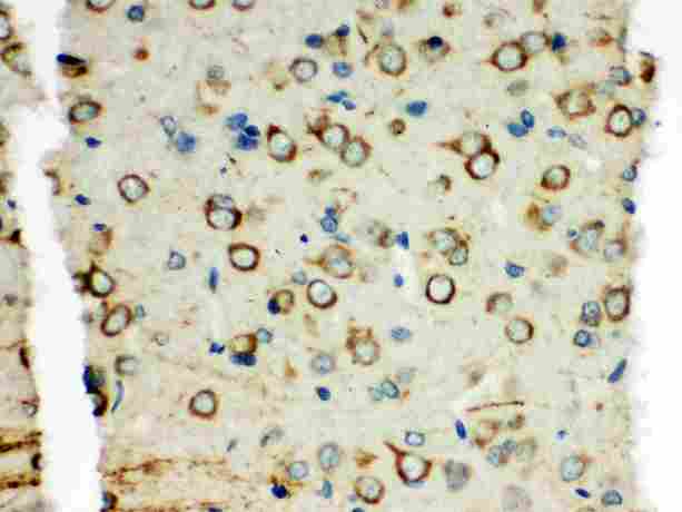 XRCC3 Antibody - IHC analysis of XRCC3 using anti-XRCC3 antibody. XRCC3 was detected in paraffin-embedded section of rat brain tissues. Heat mediated antigen retrieval was performed in citrate buffer (pH6, epitope retrieval solution) for 20 mins. The tissue section was blocked with 10% goat serum. The tissue section was then incubated with 1µg/ml rabbit anti-XRCC3 Antibody overnight at 4°C. Biotinylated goat anti-rabbit IgG was used as secondary antibody and incubated for 30 minutes at 37°C. The tissue section was developed using Strepavidin-Biotin-Complex (SABC) with DAB as the chromogen.