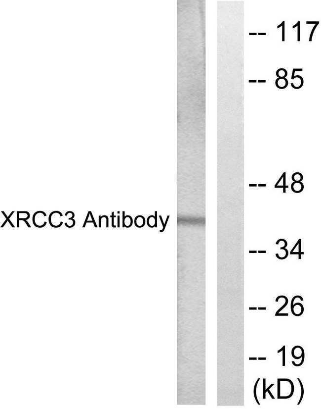 XRCC3 Antibody - Western blot analysis of lysates from HepG2 cells, treated with Adriamycin 0.5uM 5h, using XRCC3 Antibody. The lane on the right is blocked with the synthesized peptide.