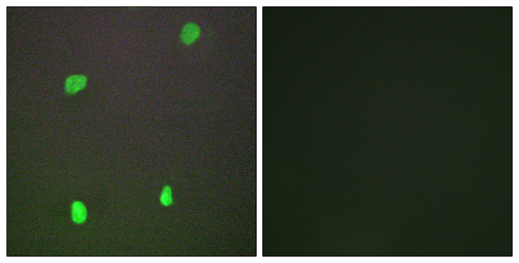 XRCC3 Antibody - Immunofluorescence analysis of COS7 cells, using XRCC3 Antibody. The picture on the right is blocked with the synthesized peptide.
