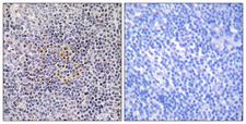 XRCC3 Antibody - Immunohistochemistry analysis of paraffin-embedded human tonsil tissue, using XRCC3 Antibody. The picture on the right is blocked with the synthesized peptide.