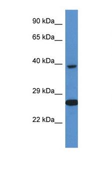 XRCC3 Antibody - XRCC3 antibody Western blot of ACHN Cell lysate. Antibody concentration 1 ug/ml.  This image was taken for the unconjugated form of this product. Other forms have not been tested.