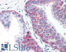 XRCC3 Antibody - Anti-XRCC3 antibody IHC of human prostate. Immunohistochemistry of formalin-fixed, paraffin-embedded tissue after heat-induced antigen retrieval. Antibody concentration 5 ug/ml.  This image was taken for the unconjugated form of this product. Other forms have not been tested.