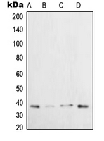 XRCC3 Antibody - Western blot analysis of XRCC3 expression in HeLa (A); H1299 (B); U2OS (C); HepG2 (D) whole cell lysates.