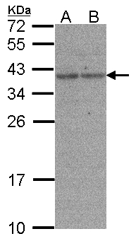 XRCC3 Antibody - Sample(30 g of whole cell lysate). A: H1299. B: HeLa S3. 12% SDS PAGE. XRCC3 antibody diluted at 1:500.