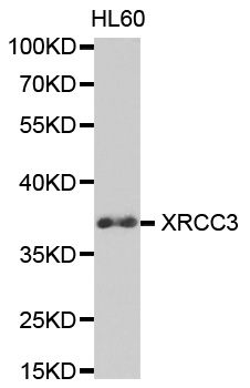 XRCC3 Antibody - Western blot analysis of extracts of HL60 cell lines.