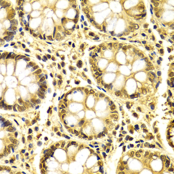 XRCC3 Antibody - Immunohistochemistry of paraffin-embedded human colon tissue.