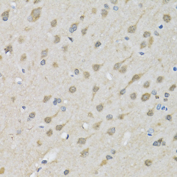 XRCC3 Antibody - Immunohistochemistry of paraffin-embedded rat brain tissue.