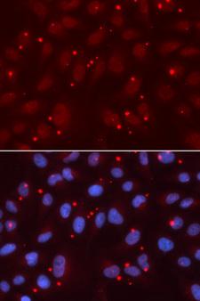 XRCC3 Antibody - Immunofluorescence analysis of U2OS cells.