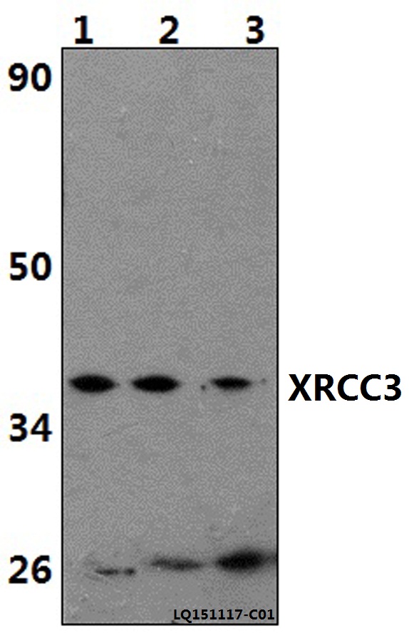 XRCC3 Antibody - Western blot of XRCC3 polyclonal antibody at 1:500 dilution. Lane 1: HeLa whole cell lysate (40 ug). Lane 2: The Kidney tissue lysate of Rat(40 ug). Lane 3: The Kidney tissue lysate of Mouse(40 ug).