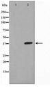 XRCC3 Antibody - Western blot of HepG2 cell lysate using XRCC3 Antibody