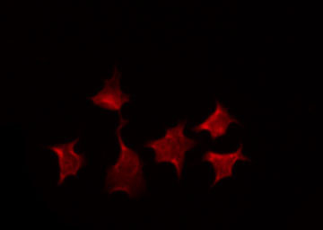 XRCC3 Antibody - Staining HepG2 cells by IF/ICC. The samples were fixed with PFA and permeabilized in 0.1% Triton X-100, then blocked in 10% serum for 45 min at 25°C. The primary antibody was diluted at 1:200 and incubated with the sample for 1 hour at 37°C. An Alexa Fluor 594 conjugated goat anti-rabbit IgG (H+L) Ab, diluted at 1/600, was used as the secondary antibody.