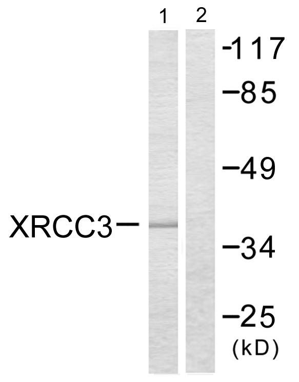 XRCC3 Antibody - Western blot analysis of extracts from HepG2 cells, treated with Adriamycin (0.5uM, 5hours), using XRCC3 antibody.