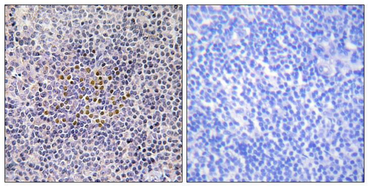 XRCC3 Antibody - Peptide - + Immunohistochemistry analysis of paraffin-embedded human tonsil tissue using XRCC3 antibody.