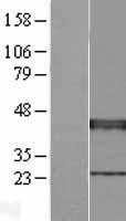 XRCC3 Protein - Western validation with an anti-DDK antibody * L: Control HEK293 lysate R: Over-expression lysate