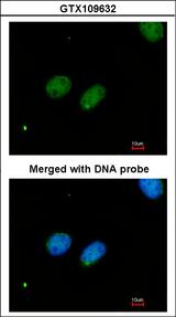XRCC4 Antibody - Immunofluorescence of paraformaldehyde-fixed HeLa using XRCC4 antibody at 1:200 dilution.