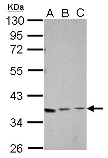 XRCC4 Antibody - Sample (30 ug of whole cell lysate). A: Jurkat, B: K562, C: HL-60. 10% SDS PAGE. XRCC4 antibody diluted at 1:1000.