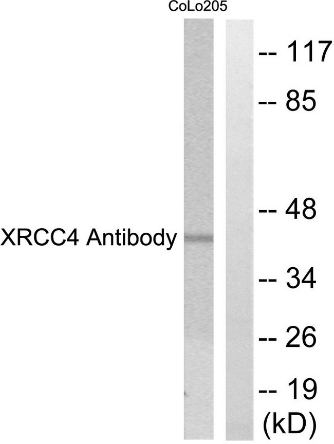 XRCC4 Antibody - Western blot analysis of lysates from COLO205 cells, using XRCC4 Antibody. The lane on the right is blocked with the synthesized peptide.