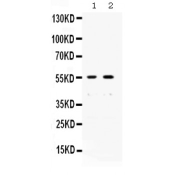 XRCC4 Antibody - Western blot analysis of XRCC4 expression in SW620 whole cell lysates (lane 1) and A431 whole cell lysates (lane 1). XRCC4 at 55 kD was detected using rabbit anti- XRCC4 Antigen Affinity purified polyclonal antibody at 0.5 ug/mL. The blot was developed using chemiluminescence (ECL) method.