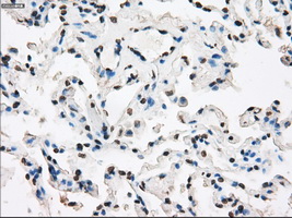 XRCC4 Antibody - IHC of paraffin-embedded lung tissue using anti-XRCC4 mouse monoclonal antibody. (Dilution 1:50).