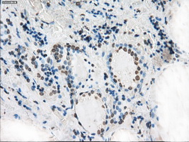 XRCC4 Antibody - IHC of paraffin-embedded thyroid tissue using anti-XRCC4 mouse monoclonal antibody. (Dilution 1:50).