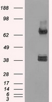 XRCC4 Antibody - HEK293T cells were transfected with the pCMV6-ENTRY control (Left lane) or pCMV6-ENTRY XRCC4 (Right lane) cDNA for 48 hrs and lysed. Equivalent amounts of cell lysates (5 ug per lane) were separated by SDS-PAGE and immunoblotted with anti-XRCC4.