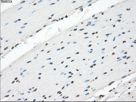 XRCC4 Antibody - IHC of paraffin-embedded colon tissue using anti-XRCC4 mouse monoclonal antibody. (Dilution 1:50).