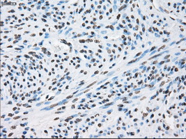 XRCC4 Antibody - IHC of paraffin-embedded endometrium tissue using anti-XRCC4 mouse monoclonal antibody. (Dilution 1:50).