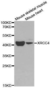 XRCC4 Antibody - Western blot analysis of extracts of various cell lines, using XRCC4 antibody at 1:1000 dilution. The secondary antibody used was an HRP Goat Anti-Rabbit IgG (H+L) at 1:10000 dilution. Lysates were loaded 25ug per lane and 3% nonfat dry milk in TBST was used for blocking.