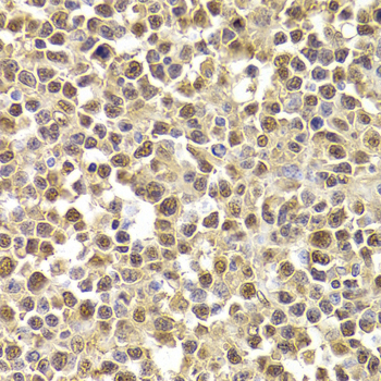 XRCC4 Antibody - Immunohistochemistry of paraffin-embedded human B cell lymphoma using XRCC4 Antibodyat dilution of 1:200 (40x lens).