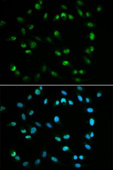 XRCC4 Antibody - Immunofluorescence analysis of U2OS cells using XRCC4 antibodyat dilution of 1:100. Blue: DAPI for nuclear staining.