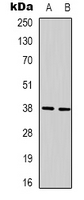 XRCC4 Antibody - Western blot analysis of XRCC4 expression in HeLa (A); 293T (B) whole cell lysates.