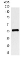 XRCC4 Antibody - Immunoprecipitation of XRCC4 from 0.5mg HeLa whole cell extract lysate; using Anti-XRCC4 Antibody.