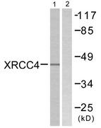 XRCC4 Antibody - Western blot analysis of extracts from COLO205 cells, using XRCC4 antibody.