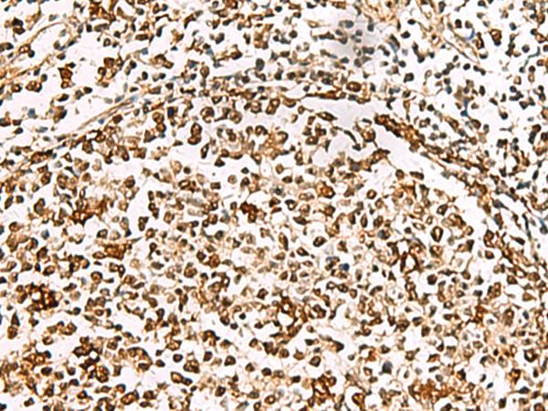 XRCC4 Antibody - Immunohistochemistry of paraffin-embedded Human tonsil tissue  using XRCC4 Polyclonal Antibody at dilution of 1:60(×200)