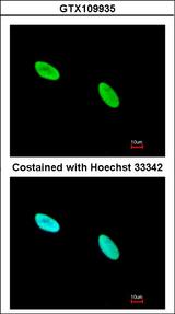 XRCC5 / Ku80 Antibody - Immunofluorescence of methanol-fixed HeLa using Ku80 (XRCC5) antibody at 1:200 dilution.