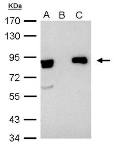 XRCC5 / Ku80 Antibody - Ku80 (XRCC5) antibody immunoprecipitates Ku80 protein in IP experiments. IP Sample:1000 ug HeLa whole cell lysate/extract A. 40 ug HeLa whole cell lysate/extract B. Control with 2.5 ug of preimmune rabbit IgG C. Immunoprecipitation of Ku80 protein by 2.5 ug of Ku80 antibody 7.5% SDS-PAGE The immunoprecipitated Ku80 protein was detected by Ku80 antibody diluted at 1:1000. EasyBlot anti-rabbit IgG (anti-rabbit IgG (HRP) -01) was used as a secondary reagent.