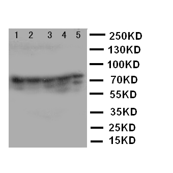 XRCC5 / Ku80 Antibody - WB of XRCC5 / Ku80 antibody. Lane 1: JURKAT Cell Lysate. Lane 2: CEM Cell Lysate. Lane 3: RAJI Cell Lysate. Lane 4: COLO320 Cell Lysate. Lane 5: HT1080 Cell Lysate.