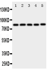 XRCC5 / Ku80 Antibody - Anti-Ku80 antibody, Western blotting All lanes: Anti Ku80 at 0.5ug/ml Lane 1: JURKAT Whole Cell Lysate at 40ug Lane 2: CEM Whole Cell Lysate at 40ug Lane 3: RAJI Whole Cell Lysate at 40ug Lane 4: COLO320 Whole Cell Lysate at 40ug Lane 5: HT1080 Whole Cell Lysate at 40ug Predicted bind size: 83KD Observed bind size: 83KD