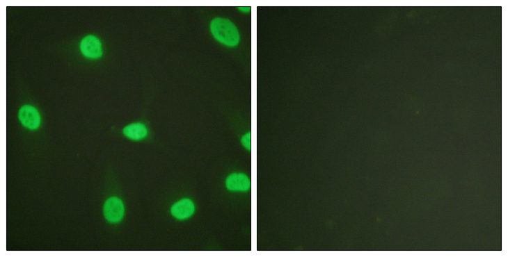 XRCC5 / Ku80 Antibody - Immunofluorescence analysis of HeLa cells, using Ku80 Antibody. The picture on the right is blocked with the synthesized peptide.