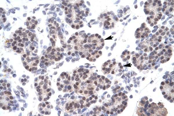 XRCC5 / Ku80 Antibody - XRCC5 / Ku80 antibody ARP34121_T100-NP_066964-XRCC5 Antibody IHC of formalin-fixed, paraffin-embedded human Pancreas. Positive label: Epithelial cells of pancreatic acinus indicated with arrows. Antibody concentration 4-8 ug/ml. Magnification 400X.  This image was taken for the unconjugated form of this product. Other forms have not been tested.