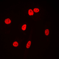 XRCC5 / Ku80 Antibody - Immunofluorescent analysis of Ku80 staining in HeLa cells. Formalin-fixed cells were permeabilized with 0.1% Triton X-100 in TBS for 5-10 minutes and blocked with 3% BSA-PBS for 30 minutes at room temperature. Cells were probed with the primary antibody in 3% BSA-PBS and incubated overnight at 4 C in a humidified chamber. Cells were washed with PBST and incubated with a DyLight 594-conjugated secondary antibody (red) in PBS at room temperature in the dark. DAPI was used to stain the cell nuclei (blue).