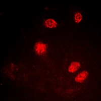 XRCC5 / Ku80 Antibody - Immunofluorescent analysis of Ku80 (pT714) staining in A549 cells. Formalin-fixed cells were permeabilized with 0.1% Triton X-100 in TBS for 5-10 minutes and blocked with 3% BSA-PBS for 30 minutes at room temperature. Cells were probed with the primary antibody in 3% BSA-PBS and incubated overnight at 4 deg C in a humidified chamber. Cells were washed with PBST and incubated with a DyLight 594-conjugated secondary antibody (red) in PBS at room temperature in the dark. DAPI was used to stain the cell nuclei (blue).